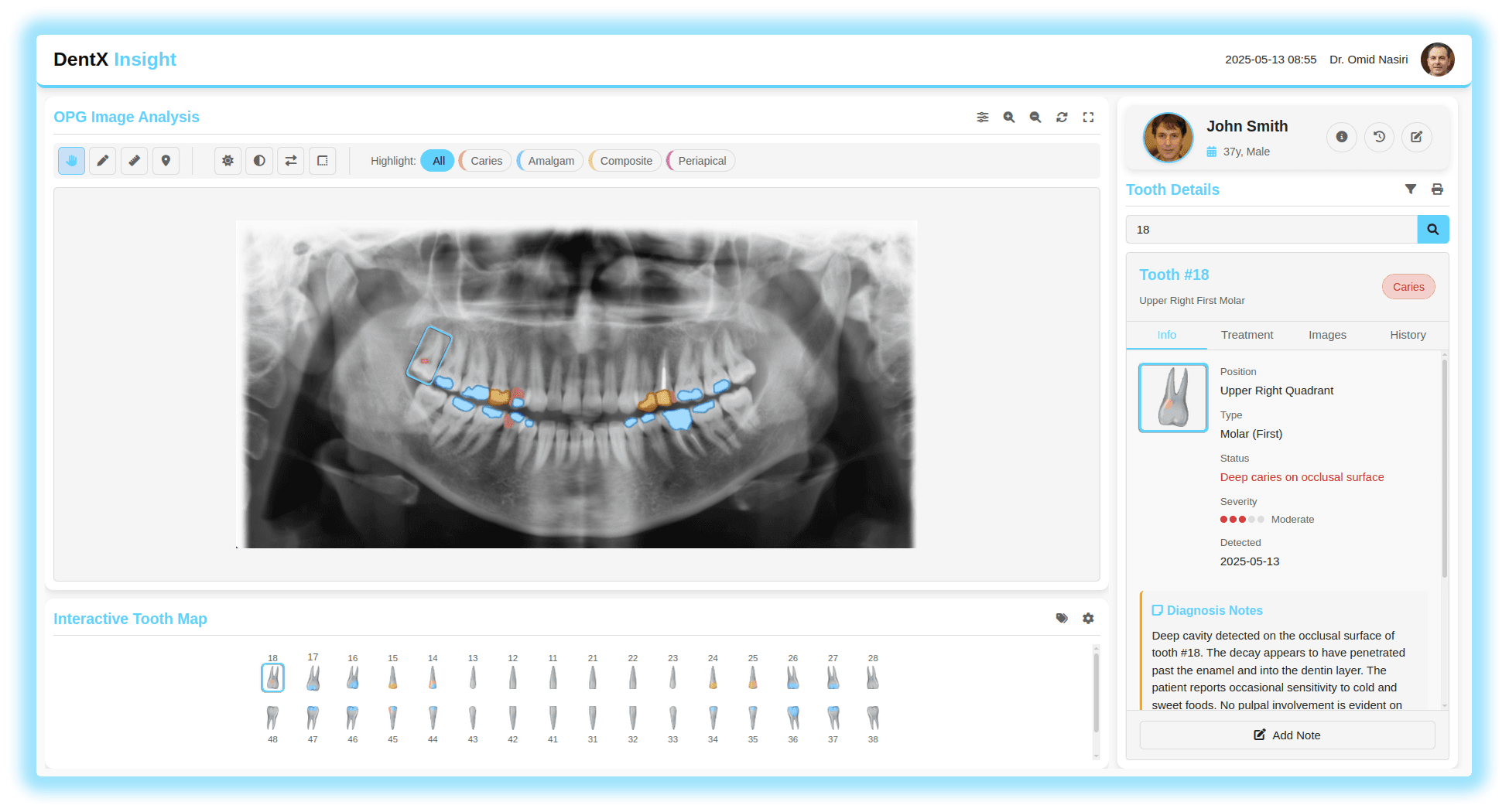 dentx-insight