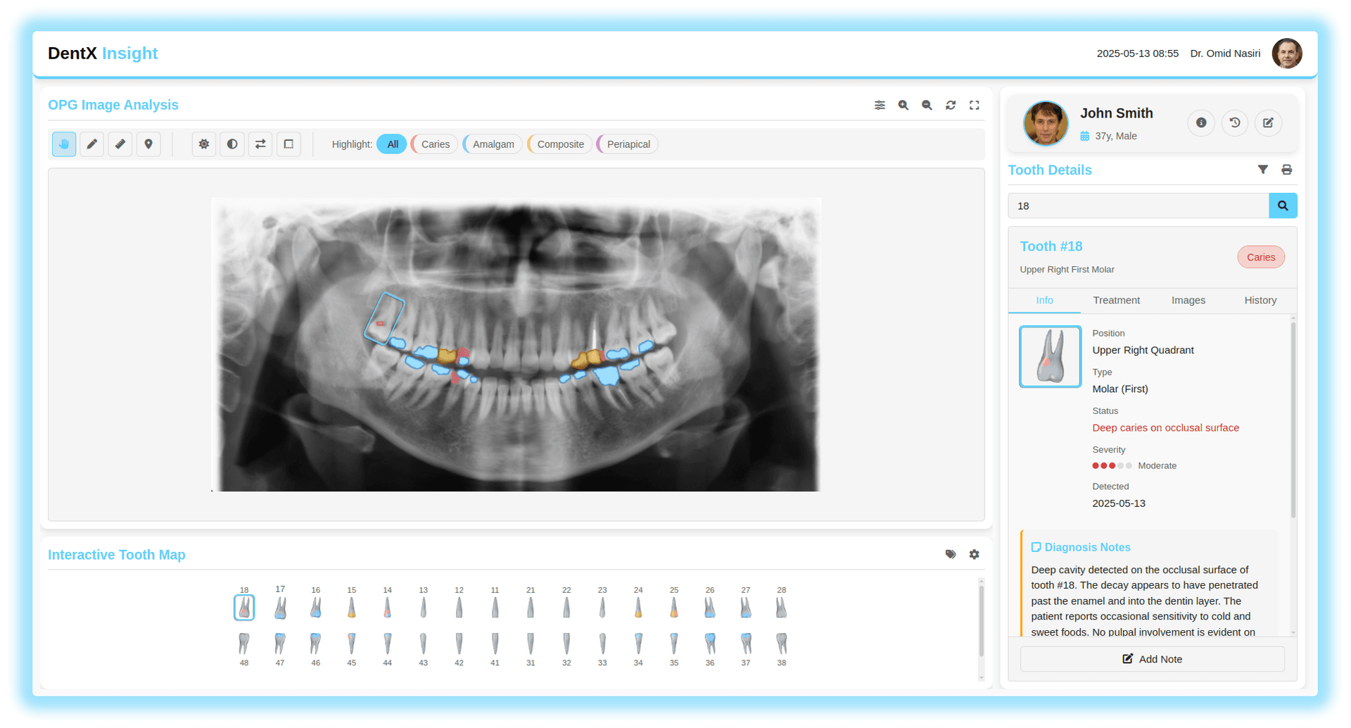 dentx-insight